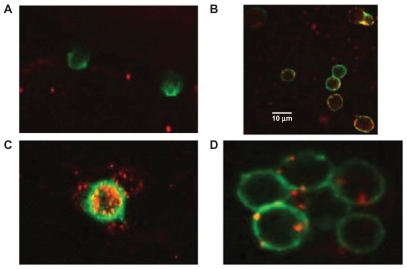 Figure 8 Interaction of engineered exosomes with cells of the immune system. A) Engineered exosomes (red small circles) coated with A2*MHC class I molecules bound to CMV peptides do not bind CD8+ T cell (stained green) from a CMV positive donor who is HLA A2 negative, showing that exosomes do not bind randomly to T cells and that binding is very much MHC dependant. B) However, when the same exosomes carrying A2*MHC/CMV complexes are cocultured with T cell from a CMV+ and A2+ donor, direct interaction between exosomes and CD8+ T cells is clearly seen. C) Engineered exosomes (stained red) also bind to natural APCs (stained green and orange when the red and green color overlaps). This figure shows a natural APC activating three different CD8 T cells via engineered exosomes. D) Exosomes bind to APC naturally whether they are engineered or not as the lipids themselves are the binding sites. Copyright © 2009, Nature Publishing Group. de La Pena H, Madrigal JA, Rusakiewicz S, et al. Artificial exosomes as tools for basic and clinical immunology. J Immunol Methods. 2009;344(2):121–132.