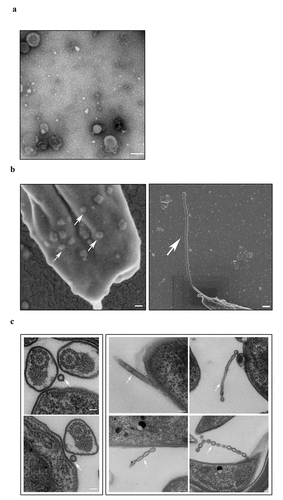 Figure 5. Physical characterizations of TeEVs. (a) The partially flat ball-shaped vesicles were observed using negative staining by TEM. Scale bar = 100 nm. (b) EVs on the surface of T. evansi (left, scale bas = 100 nm) and the nanotubes protruded from the posterior end of T. evansi (right, scale bar = 200 nm) were visualized by SEM. (c) Thin section TEM analysis of EVs (left) and nanotubes (right). The membranes of EVs and nanotubes were similar to the cell plasma membrane and the nanotubes were dissociated to produce free EVs. Scale bars = 100 nm