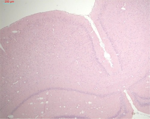 Figure 8 H&E-stained brain tissue after optimal ultrasound treatment.Notes: Every tenth brain section was stained with H&E. No tissue or capillary damage was noted in rats treated with sonication. An example section is shown. Bar 200 μm.Abbreviation: H&E, hematoxylin-eosin.