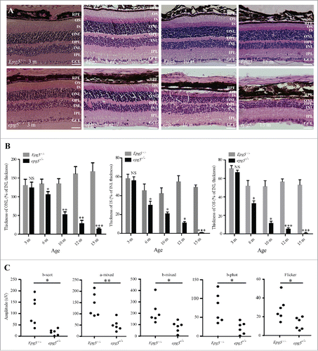 Figure 1. Retinal degeneration in epg5 knockout mice. (A) Histological analysis of retinas from epg5−/− and Epg5+/− mice at the age of 3, 6, 10 and 15 mo. All sections were stained with hematoxylin-eosin and photographed from the first dorsal location (∼0.18 mm from the optic nerve head) at the same magnification (200 ×). Scale bars: 50 µm. RPE, retinal pigment epithelium; GCL, ganglion cell layer; IPL, inner plexiform layer; INL, inner nuclear layer; OPL, outer plexiform layer; ONL, outer nuclear layer; IS, inner segments; OS, outer segments. As a result of embedding, the RPE layer occasionally separates from the photoreceptor segments. (B) Temporal changes in retinal degeneration, presented as thickness of ONL, IS and OS normalized to INL thickness to correct for sectioning artifacts, in epg5−/− and Epg5+/− mice at the age of 3, 6, 10, 12 and 15 mo. Progressive decrease in the thickness of ONL, IS and OS is observed in epg5−/− retinas from 6 mo onwards. At 15 mo, the IS and OS are barely detected in epg5−/− mice. *P < 0.05, **P < 0.01, ***P < 0.001. Statistical comparisons were performed with 2-tailed, unpaired Student t tests. (C) The amplitudes of scotopic (dark-adapted) b-wave, mixed a-wave and mixed b-wave, and photopic (light-adapted) b-wave and flicker responses from epg5−/− and Epg5+/− mice at 6 mo (n = 6). *P < 0.05, **P < 0.01. Data were compared with 2-tailed, unpaired Student t tests.