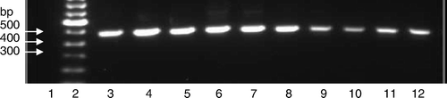 Figure 3.  Amplification of field sample RNAs by RT-PCR using the CAstV-for and CAstV-rev primers. Lane 1, negative control; lane 2, molecular weight marker; lane 3, VF07-05/3; lane 4, VF07-05/6, lane 5, VF07-14/4; lane 6, VF06-01/3; lane 7, VF06-07/1; lane 8, VF07-13/7, lane 9, VF05-01/3; lane 10, VF05-01/14; lane 11, VF04-01/2 and lane 12, VF04-01/11.