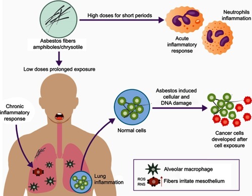 Figure 1 Cellular damage induced by exposure to asbestos. High doses of asbestos during short periods promote acute inflammation of neutrophils. Low doses during prolonged exposure periods promote neutrophil accumulation and thus acute inflammation. Free radicals, ROS and RNS result from the chronic inflammation generated by the prolonged phagocytic activity by macrophages. This condition causes DNA damage inducing the activation of proto-oncogenes, cell proliferation, and susceptibility to mutations.Abbreviations: ROS, reactive oxygen species; RNS, reactive nitrogen species.