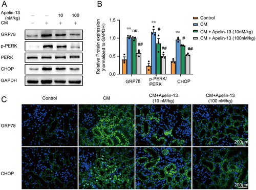 Figure 5. Apelin-13 attenuated iohexol-induced ER stress in rat tubular cells. Rats were treated as described above. The expression of GRP78, p-PERK, PERK and CHOP in kidney tissues was detected by immunoblot analysis. Immunofluorescence was used to detect the expression of GRP78 and CHOP in kidney tissues. (A, B) Representative immunoblot analysis and semi-quantitative analysis of GRP78, p-PERK, PERK, CHOP in rat kidney tissues, GAPDH was used as a loading control. (C) Representative immunofluorescence images of the GRP78 and CHOP. *p < 0.05, **p < 0.01, significantly different from control group; #p < 0.05, ##p < 0.01, significantly different from the CM group. All quantitative data are expressed as means ± SEMs, n = 3.