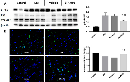 Figure 7 STAMP2 induces NMRAL1 translocation to the nucleus and negatively regulates NF-κB signaling. (A): Western blot analysis of p-p65, p65 and STAMP2 expression in the control, DM, vehicle and STMAP2 groups. Data for 6 rats in each group were compared using t tests. (B): Representative immunofluorescence of NMRAL1 showing the intra- and extranuclear distribution and ratio of nuclei with NMRAL1 imbedded to total nuclei in the control, DM, vehicle and STMAP2 groups. Data for 8 rats in each group were compared using χ²-tests. *p<0.05 vs vehicle, **p<0.01 vs vehicle, #p<0.05 vs DM, $$p<0.01 vs control.