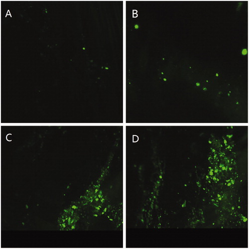 Figure 6. Fluorescence microscopic images of microtome section of intestinal epithelium after 2 h of oral administration of different samples (A) TCS solution; (B) CS/HP-55 NPs; (C)TCS/TPP NPs; (D)TCS/HP-55 NPs.