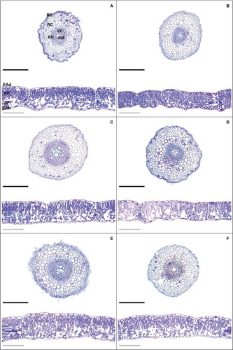 Figure 1. Root and leaf cross sections in soybean plants treated with EBR and subjected to waterlogging. Control + 0 nM EBR (a), waterlloging + 0 nM EBR (b), control + 5 nM EBR (c), waterlloging + 5 nM EBR (d), control + 10 nM EBR (e), waterlloging + 10 nM EBR (f). Legends: RE = Root epidermis; RC = Root cortex; RD = Root endodermis; VC = Vascular cylinder; RM = Root metaxylem; EAd = adaxial epidermis; EAb = Adaxial epidermis; PP = Palisade parenchyma; SP = Spongy parenchyma. Black bars = 500 µm and gray bars = 200 µm