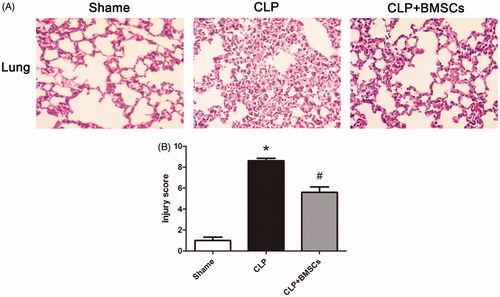 Figure 3. (A) Representative photomicrographs of lung tissues stained with hematoxylin and eosin 24 h after the surgery. The sections are shown at ×400 magnification. CLP caused the infiltration of inflammatory cells into the interstitium and alveolar spaces of the lung, alveolar wall thickening, and intra-alveolar exudation. (B) Histological scoring of lung injury in different groups was quantified, as described in the “Materials and methods” section. Lung-injury score significantly decreased in the CLP + BMSCs group compared with the CLP control group. Data are expressed as mean ± SEM (n = 4, per group), and were compared by one-way ANOVA and SNK method; *p < 0.05 versus the sham group; #p < 0.05 versus the CLP control group. ANOVA: Analysis of Variance; CLP: cecal ligation and puncture; SEM: standard error of the mean; SNK: Student–Newman–Keuls.