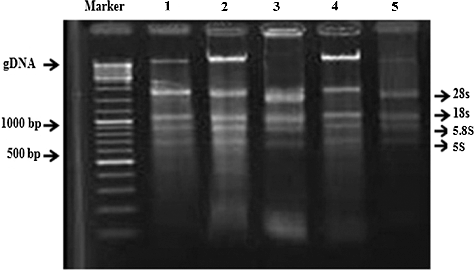 Figure 1. Separation of ribonucleic acids, RNA, extracted from rice leaves using five methods. Lane 1: method 1 (CTAB); lane 2: method 2 (SDS); lane 3: method 3 (TRIzol); lane 4: method 4 (Invitrogen); and lane 5: method 5 (Qiagen kit) with 1.5% agarose gel electrophoresis and ethidium bromide staining (2 µg/mL for 10 min). Marker: O'GeneRuler TM DNA Ladder Mix (Fermentas, Waltham, Massachusetts, USA).