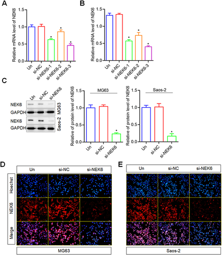 Figure 3 NEK6 was downregulated by siRNAs in osteosarcoma cells. (A) The mRNA levels of NEK6 were inhibited by NEK6 specific-targeted siRNAs (si-NEK6-1, si-NEK6-2 and si-NEK6-3) in MG63 cells detected by RT-qPCR. (B) The mRNA levels of NEK6 were inhibited by NEK6 specific-targeted siRNAs (si-NEK6-1, si-NEK6-2 and si-NEK6-3) in Saos-2 cells detected by RT-qPCR. si-NEK6-3 was the best silence of NEK6 expression, and labeled as si-NEK6 for following experiments. (C) The protein levels of NEK6 in human different osteosarcoma cells including MG63, U-2 OS and Saos-2 cells. (D) NEK6 expression in MG63 cells detected by immunofluorescence staining. (E) NEK6 expression in Saos-2 cells detected by immunofluorescence staining, scale bar=50 μm. *P<0.05 vs untreated cells (Un).