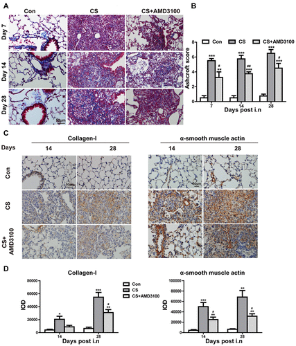 Figure 7 Blockade CXCR4 attenuated pulmonary fibrosis in silicosis mice. (A) Representative presentation of Masson’s trichrome staining of the whole lung tissue section on days 7, 14, and 28. (B) Quantitative analysis of Ashcroft score in the lung among three groups was presented. N=4 per group. (C) Immunohistochemical staining of collagen I and α-SMA were shown on days 14 and 28 after CS exposure. Quantitative analysis of collagen I and α-SMA immunohistochemical staining was shown in (D) after CS-challenged. IOD: integrated optical density. Scale bar: 50 µm. *P < 0.05, **P < 0.01, ***P < 0.001 vs the control group. #P < 0.05, ##P < 0.01 vs the CS group.