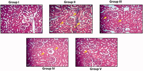 Figure 9. Nephroprotective effect of silver nanoparticles synthesized from Alpinia officinarum (lesser galangal) traditional Chinese medicinal plant (AG-AO) on histopathological changes in kidney tissue of cisplatin induced nephrotoxicity model. The control and experimental rat’s kidney tissue were processed for histological analysis and sectioned into slices of 5 micron thickness. The sectioned slides were stained with haematoxylin and eosin stains. The stained slides were viewed under light microscope and photographed. The experiments were performed in triplicates.