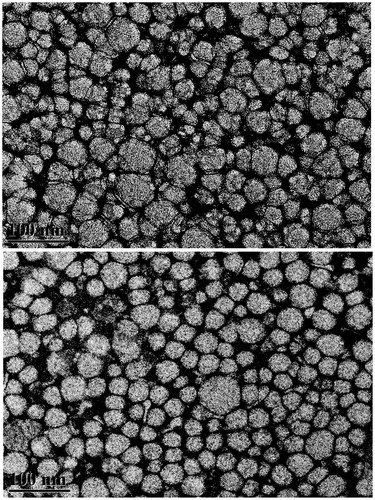 Figure 2. Transmission electron microscopy images of heLDL and RPT–heLDL at ×45 000 magnification. Top: native heLDL. Bottom: RPT–heLDL.