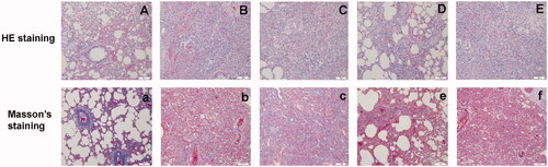 Figure 9. Images of lung tissue on day 14 stained with hematoxylin and eosin (HE) and Masson’s trichrome (×200) in the sham-operation group (A, a), model group (B, b), low-dose group (C, c), middle-dose group (D, d), and high-dose group (E, e).