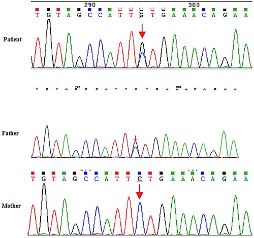 Figure 2. Sequencing diagram of family members. Sequencing diagrams indicate the presence of the ANK1 mutation in the proband and his father but not in his mother.