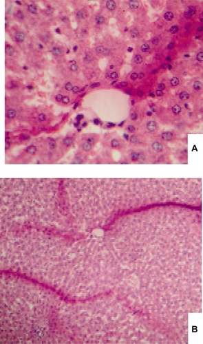 Figure 1 The figures of the liver tissue injected with the reduced size acetaminophen, (A) with high resolution, and (B) with low resolution.