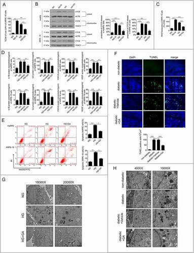 Figure 4. LMP is involved in HG-induced mitochondrial dysfunction, cytokine release, and apoptosis of RPE cells. (a) ARPE-19 cells were pretreated with GA (1 mM) or rotenone (R, 0.5 μM) for 1 h and then exposed to HG for 24 h. The Δψm values were analyzed by fluorometry, n = 6. (b) HsRPE and ARPE-19 cells were processed as described in (A). Cytosolic and mitochondrial CYCS levels were independently analyzed by western blot with anti-CYCS, anti-ACTB, and anti-VDAC1. ACTB was used as a protein loading control in the cytosol, while VDAC1 was used as a protein loading control in the mitochondria. The percentage of CYCS released from mitochondria into the cytosol was analyzed. Representative images from three independent experiments with biological and technical replicates are shown, n = 6. (c) ARPE-19 cells were processed as described in (A). The intracellular ROS levels were analyzed using DCFH-DA with fluorometry, n = 6. (d) HsRPE and ARPE-19 cells were pretreated with geldanamycin (GA, 1 mM) or vehicle for 1 h and then exposed to HG for 24 h. The levels of IL1B, IL6, CXCL8, and VEGF in serum were analyzed by ELISA, n = 6. (e) HsRPE and ARPE-19 cells were pretreated with GA (1 mM) for 1 h and then exposed to HG for 24 h. The proportion of apoptotic cells was analyzed using ANXA5-FITC-PI by flow cytometry, n = 6. (f) The RPE cells were flat-mounted, and TUNEL images were taken of RPE cells in non-diabetic rats, STZ-induced diabetic rats (diabetic), and rats treated for 7 days with vehicle or GA (100 mg/kg by intraperitoneal injection). All rats were fed with a regular diet. The pictures were taken on the upper retina 100 μm away from the optic nerve. Representative images from three independent experiments with biological and technical replicates are shown. Scale bars: 20 μm, n = 10. (g) ARPE-19 cells were processed as described in (E). Representative TEM images. Magnifications of the boxed areas are presented on the right. black delineation, AP; red delineation, electron-dense APL. Note the accumulation of APL in HG conditions. Scale bars: 2 μm (left), 1 μm (right), n = 6. (h) Rats were processed as described in (F). Representative TEM images of retina sections in rats. Scale bars: 5 μm (left), 2 μm (right), n = 10. *P < 0.05; **P < 0.01; ***P < 0.001.