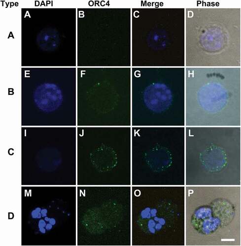 Figure 2. Four types of MEL cells are detected by ORC4 staining after Vacuolin-1 treatment that suggest a progressive model towards enucleation. MEL cells were treated with Vacuolin-1 for 48 hrs and stained with antibodies to ORC4. Four different types of cells were identified. (A–D) Type A cells had no ORC4 staining. (E–F) Type B cells had a small amount of ORC4 staining surrounding the nuclei of the cells. (I–L) Type C cells had more intense staining of ORC4 around slightly condensed nuclei. (M–P) Type D cell were enucleating MEL cells which had more intense ORC4 staining throughout both the pyrenocyte and reticulocyte. Cells were stained for DAPI (A, E, I, M) and ORC4 (B, F, J, N). Merged fluorescence (C, G, K, O), and phase (D, H, L, P) images are shown. Bar = 5 µm