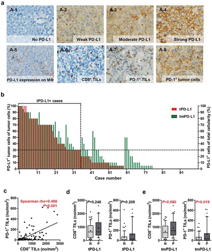 Figure 1. Tumoral and non-tumoral PD-L1 expression is positively correlated with the numbers of CD8+ and PD-1+ TILs. (a) Representative IHC images of PD-L1, PD-1, and CD8. PD-L1 was expressed on tumor cells (A-1–4) and surrounding non-tumoral cells, primarily macrophages (A-5), concurrently or alone. CD8 and PD-1 were expressed on TILs (A-6–7), and PD-1 was expressed on tumor cells (A-8). Percentages of PD-L1+ cells of the tumor cells (tPD-L1, red bar) and those of PD-L1+ cells of the total cellularity including tumor cells and non-tumor cells (tmPD-L1, green bar) in each case are displayed (b). The correlation between the numbers of CD8+ TIL and PD-1+ TIL were assessed by Spearman correlation analysis (c). Numbers of CD8+ TILs and PD-1+ TILs in tPD-L1– and tPD-L1+ cases (d) and tmPD-L1 – and tmPD-L1+ cases (e). Differences were analyzed using the Mann-Whitney U test. Whiskers, 10th to 90th percentiles; midline of the box, median; +, mean. Points below and above the whiskers are individual points. Abbreviations: MΦ, macrophage; N, negative; P, positive.