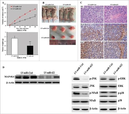 Figure 3. Overexpression of miR-622 suppresses tumor growth in vivo. (A) (top) Tumor growth curves determined after injection of MHHC-97H cells infected with miR-622-expressing or control lentivirus into nude mice. (bottom) Tumor weight was measured at the end of the experiment. **, P < 0.01. (B) Photographs of tumor-bearing mice and resected tumors. (C) Representative tumor sections stained with H&E and anti-Ki-67 and anti-MAP4K4 antibodies. Original magnification,×400. (D) Western blot analysis of indicated proteins in miR-622-overexpressing and control xenograft tumors. Representative blots of 3 independent experiments are shown. The phosphorylation of JNK and NF-κB but not ERK1/2 or p38 was reduced by miR-622 overexpression.