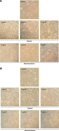 Figure 7 Morphological changes in H460 lung cancer cells.Notes: Change after 24 hours (A), and 48 hours (B) of treatment with curcuminoid nanoemulsions and Curcuma longa extract, as captured using Nikon TS100-F microscope at 10×10 magnification. Control represents the cells incubated with medium only.