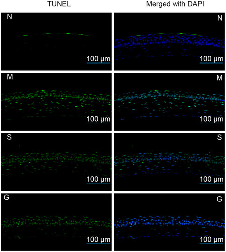 Figure 13 The apoptosis rate of corneal epithelial cells after 3 days of the administrations (N: the normal group; (M) the model group; (S) the solution group; (G) the gel group. The green fluorescence indicated the nucleus of positive apoptotic cells while blue fluorescence represented the nucleus of other cells.).