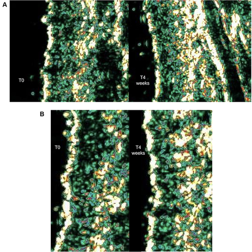 Figure 4 Digital images of skin echogenicity/density obtained by Ultrasound Scanner Dermascan showing increased echogenic dermal fibers after 4 weeks of treatment. (A) Facial serum. (B) Face cream. Courtesy of ISPE S.r.l.