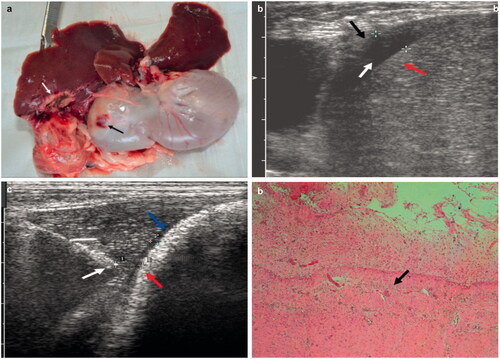 Figure 4. (a) Photograph showing the ablated areas (white arrow) and the injured stomach wall (black arrow). (b) Ultrasonographic image showing the artificial ascites were 0.6 cm wide (white arrow) between the liver (red arrows) and the diaphragm (black arrow). (c) Ultrasonographic image showing successful injection of artificial ascites, ultrasound-guided placement of ablation needle (white arrow) between the liver and the stomach wall (red arrow), and the formation of ascites 0.2 mm in width (blue arrows). (d) Histopathological examination showing thermal damage to the outer muscular layer of the stomach wall (black arrow). For interpretation of the references to colour in this figure legend, please refer to the web version of this article at informahealthcare.com.