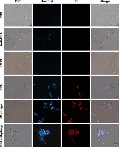 Figure 5 PPA-JM-phage induced apoptosis on Candida albicans cells.Note: Fluorescence-microscopy images showed cells stained with Hoechst and PI after treatment with PBS, anti-BSA, KM13, PPA, JM-phage, and PPA-JM-phage.Abbreviations: PPA, pheophorbide A; DIC, differential interference contrast; PI, propidium iodide.