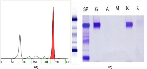 Figure 1. The results of the first serum protein electrophoresis and immunofixation electrophoresis (April 15, 2021). (A) shows that there was one M protein in the SPE. (B) shows that the immunotyping was IgG κ.