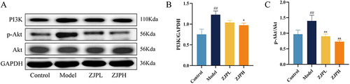 Figure 11 Effects of ZJP on PI3K/Akt signaling pathway. (A) Western blotting images of PI3K, p-Akt and Akt. (B) The relative protein expression of PI3K. (C) Relative protein expression of p-Akt. All data were expressed as means ± standard deviation (SD). Multiple comparisons were analyzed by ANOVA. ##P < 0.01 vs control group. *P < 0.05 and **P < 0.01 vs model group.