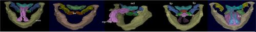 Figure S15 3D surface renditions of objects: np (nasopharynx), op (oropharynx), mn (mandible), tn (tonsils), tL & tR (left and right (tonsil), fp (fat pad), ad (adenoid), tg (tongue).Note: Copyright ©2016. PLoS One. Reproduced from Capovilla G, Beccaria F, Montagnini A, et al. Tong Y, Udupa JK, Sin S, Liu Z, Wileyto EP, Drew A et al. MR Image Analytics to Characterize the Upper Airway Structure in Obese Children with Obstructive Sleep Apnea Syndrome. PLoS One 2016; 11(8):e0159327.Citation148