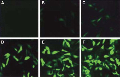 Figure 1. RA FLS cells infected by Ad-eGFP (×400) (A) control; (B) 12 h 200 MO I; (C) 36 h 50 MO I; (D) 36 h 100 MO I; (E) 36 h 200 MO I; (F) 36 h 300 MO I.