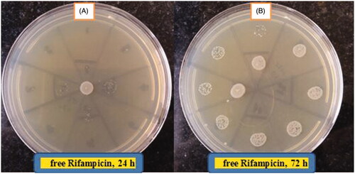 Figure 13. Free Rifampicin MIC after 24 h (A) and 72 h (B).