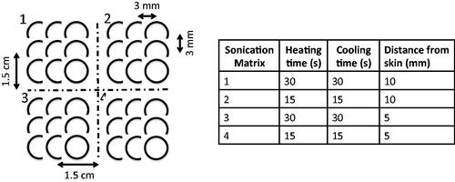 Figure 5. Sonication matrix parameters applied to both the control and skin-cooling ablation sides in the porcine model. In all cases, the power for individual sonications were adjusted to achieve a 65 °C peak temperature, independent of the heating or cooling times.