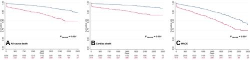 Figure 2 Kaplan-Meier survival curves of primary and secondary outcomes according to D-dimer levels. (A) Survival curves for the outcome of all-cause death. (B) Survical curves for the outcome of cardiac death. (C) Survival curves for the outcome of MACE.