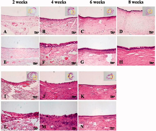 Figure 10. H&E staining. A–H. PCL-OC group. I–N. PCL group. A–D, I–K. ×200. E–H, L–N. ×400. PCL: polycaprolactone scaffold group, PCL-OC: PCL scaffold cultured in omentum for 2 weeks before transplantation group.