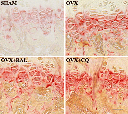 Figure 2.  Histochemical localization of alkaline phosphatase in bone sections of sham control (SHAM), ovariectomized (OVX), ovariectomized and raloxifene-treated (OVX + RAL) and ovariectomized and treated with Cissus quadrangularis extract (OVX + CQ) groups. Note the significant increase in the staining intensity in OVX, OVX + RAL, OVX + CQ groups compared to SHAM group.