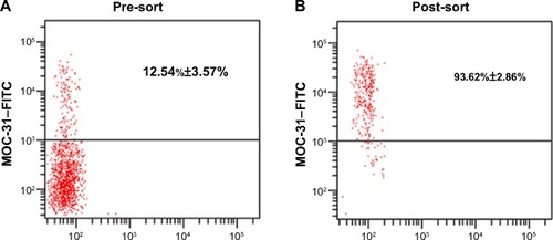 Figure 2 The different percentage of MOC-31+ cells in SLN before and after immunomagnetic beads separation by flow cytometry.Notes: After manufacturing single-cell suspension SLN, the cells were labeled with MOC-31–FITC antibody. (A) The expression of MOC-31 in SLN cells before immunomagnetic beads separation and the percentage of MOC-31+ cells is 12.54%±5.57%; (B) The expression of MOC-31 in SLN cells after immunomagnetic beads separation. After immunomagnetic beads separation, the percentage of MOC-31+ cells is 93.62%±2.86%.Abbreviations: SLN, sentinel lymph node; FITC, fluorescein isothiocyanate.