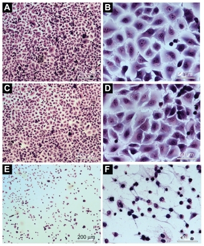 Figure 6 Morphological evaluation of the A549 cells using light microscope: A) and B) cells incubated with PBS (control). C) and D) cells incubated with empty nanoparticles suspension. E) and F) cells incubated with ZnPc-loaded nanoparticles. (A), (C), and (E) were observed at magnification of ×50 (scale 200 μm). (B), (I), and (F) were observed at magnification of ×400 (scale 50 μm).Abbreviations: PBS, phosphate-buffered saline; ZnPc, zinc phthalocyanine.