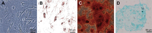 Figure S1 Isolated MSCs presented a fibroblast-like shape (A) and exhibited adipocyte (B), osteoblast (C), and chondrocyte (D) differentiation capacity.Abbreviation: MSC, mesenchymal stem cells.