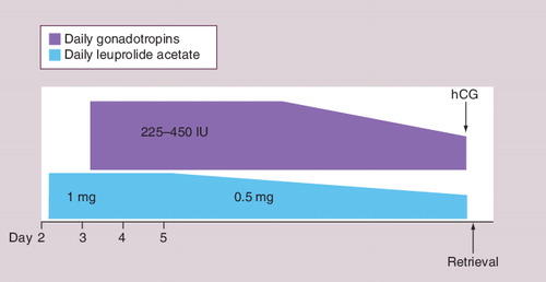 Figure 2. Standard flare protocol.hCG: Human chorionic gonadotropin; IU: International units.