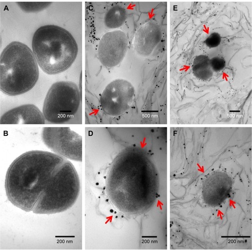 Figure 6 TEM images of MRSA cells not exposed to GO-Ag nanocomposite (A, B); and MRSA cells treated with 15 µg·mL−1 GO-Ag for 2 h (C–F). The cell membranes were severely damaged after exposure to GO-Ag. Visible damage on the cell surface is indicated by red arrows (C–F).Abbreviations: MRSA, methicillin-resistant Staphylococcus aureus; TEM, transmission electron microscopy; GO-Ag, graphene oxide-silver nanocomposite; h, hours.