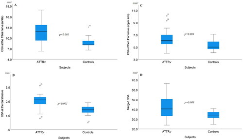 Figure 2. Boxplots showing cross-sectional areas (CSA) between 13 patients with hereditary transthyretin amyloidosis (ATTRv) and 14 healthy controls. The box shows median and percentage between 25 and 75. The whiskers showing the 95- percentage confidence interval (numbers indicating CSA data outside the 95% confidence interval). (A) CSA at the tibial nerve at the ankle, (B) CSA at the sural nerve, (C) CSA of the ulnar nerve (middle of the upper arm), and (D) Merged CSA = median CSA from the: tibial nerve at the ankle + sural nerve + peroneal nerve at popliteal fossa + median nerve at the wrist + ulnar nerve at the medial epicondyle.