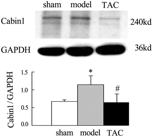 Figure 4. TAC decreased the elevation of Cabin1 protein expression in the renal cortex of nephrectomized rats. The abundance of Cabin1 in renal cortex was determined by western blot. Western blot analysis showed that relatively low level protein expression of Cabin1 in sham-operated rats. However, Cabin1 protein levels were obviously increased at 8 weeks after operation in 5/6 nephrectomized rats. While compared with the model group, treated by TAC for 4 weeks significantly decreased the elevation protein expression of Cabin1. *p < 0.05 versus sham-operated rats, #p < 0.05 versus 5/6 nephrectomized rats.