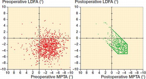 Figure 1. LDFA and MPTA comparing preoperative and postoperative distributions.