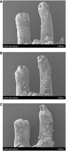 Figure 4 Scanning electron microscope micrograph of the compression side of distal root of maxillary first molar.