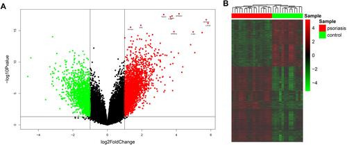 Figure 1 Identification of DEGs between psoriasis patients and healthy controls. (A) Volcano plot of DEGs. Red points represent up-regulated genes; green points represent down-regulated genes. (B) The heatmap of DEGs. Red colors indicate up-regulated genes and green colors indicate down-regulated genes.