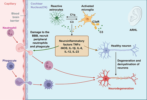 Figure 2 During age-related hearing loss progression, activated microglia can release inflammatory factors that destroy the blood–brain barrier and recruit peripheral macrophages into the center. Meanwhile, the released inflammatory factors can also directly act on neurons and cause neuronal degeneration. Concurrently, complement pathway activation may be another key factor in enhancing neuroinflammation. The flowchart was created using Biorender.com.