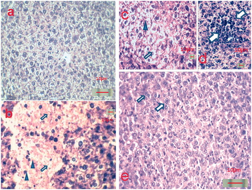 Figure 1. Hematoxylin and eosin-stained liver sections. (a) Control groups (G1 and G2) showing normal hepatic architecture with radial arrangement of hepatocytes; (b)–(d) CTX-treated group (G3) showing hepatic degeneration and pale stained areas (arrows) and coagulative necrosis of many hepatocytes with piknotic nuclei (arrowheads) (b), cellular degeneration of some hepatocytes (arrow) with nuclear chromatolysis (arrowhead) (c), cellular infiltration of eosinophils (arrows) (d), and (e) CTX- and propolis-treated group (G4) showing that hepatocytes regained normal architecture with normal chromatolized and central nuclei. Also, regeneration of hepatocytes can be noticed by the presence of binucleate cells (arrows).