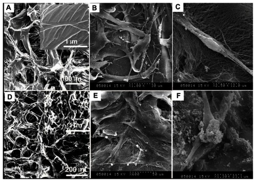 Figure 3 Scanning electron microscope images of human periodontal ligament stem cells on a pure porcine acellular dermal matrix and hydroxyapatite-coated porcine acellular dermal matrix. (A) The porcine acellular dermal matrix possesses a three-dimensional porous structure with channel diameter of about 50–100 μm. (B) Periodontal ligament stem cells adhered on the porcine acellular dermal matrix uniformly and exhibited typical fibroblast-like morphology. (C) Periodontal ligament stem cells on the porcine acellular dermal matrix extended completely and intimately adhered to the underlying collagen fibrils. (D) A hydroxyapatite three-dimensional interconnected nanostructure with 120–150 nm microchannels formed on the surface of the microchannels of the porcine acellular dermal matrix. (E) Periodontal ligament stem cells exhibited osteoblast-like morphology on the hydroxyapatite-coated porcine acellular dermal matrix. (F) Hydroxyapatite clusters precipitated on the cells and collagen fibers after cells seeding on the hydroxyapatite-coated porcine acellular dermal matrix scaffold.